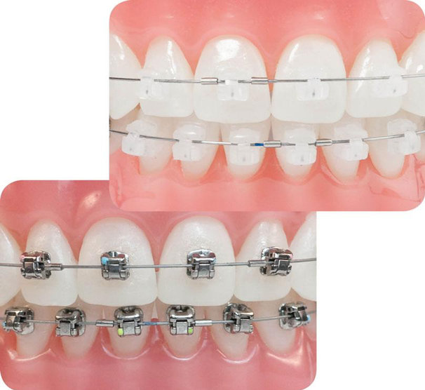 bright smile dental care bali klinik gigi