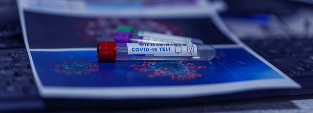 Semua Yang Perlu Anda Ketahui Tentang Tes PCR COVID-19 di Bali